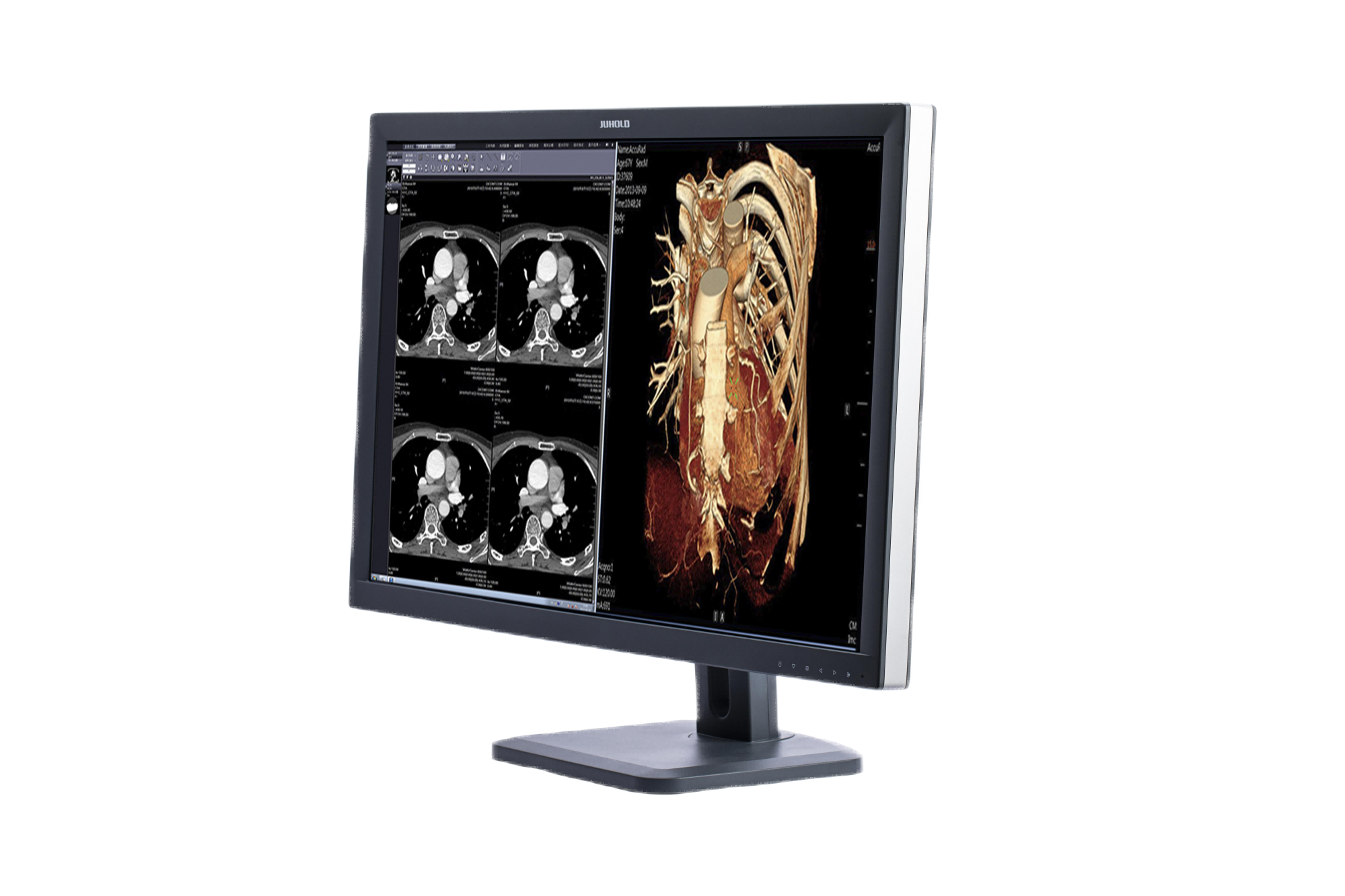 巨融医疗 SC3220 液晶显示器 